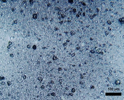 Mikroplastik-Partikel unter dem Mikroskop